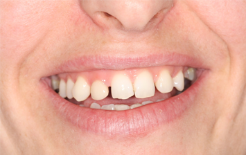 Before - Hunts Cross Dental Centre