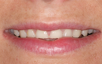 Before - Hunts Cross Dental Centre