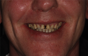 Before - Hunts Cross Dental Centre
