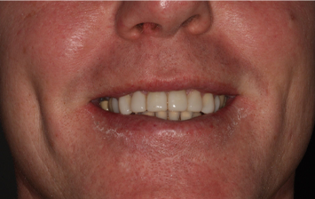 After - Hunts Cross Dental Centre