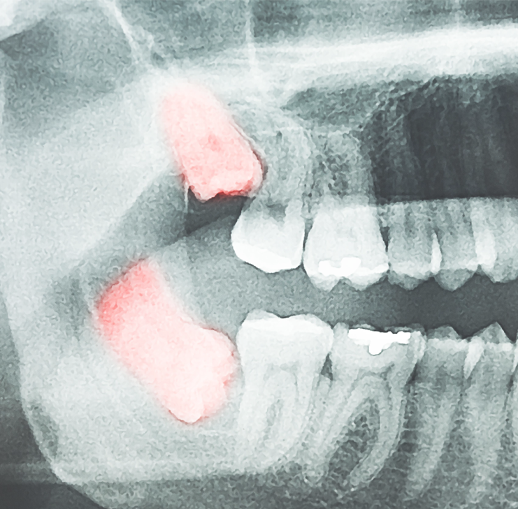 Treatment - Hunts Cross Dental Centre