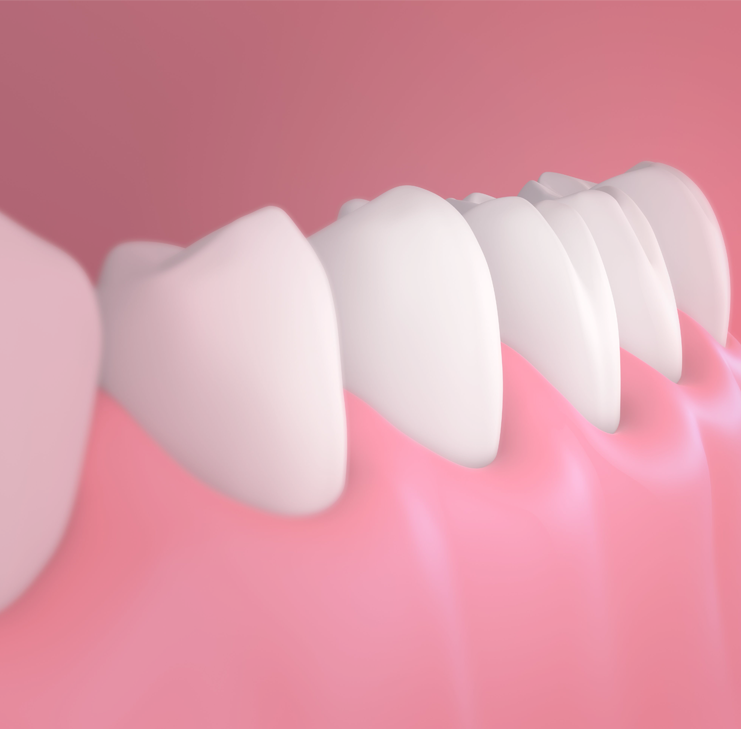 Treatment - Hunts Cross Dental Centre